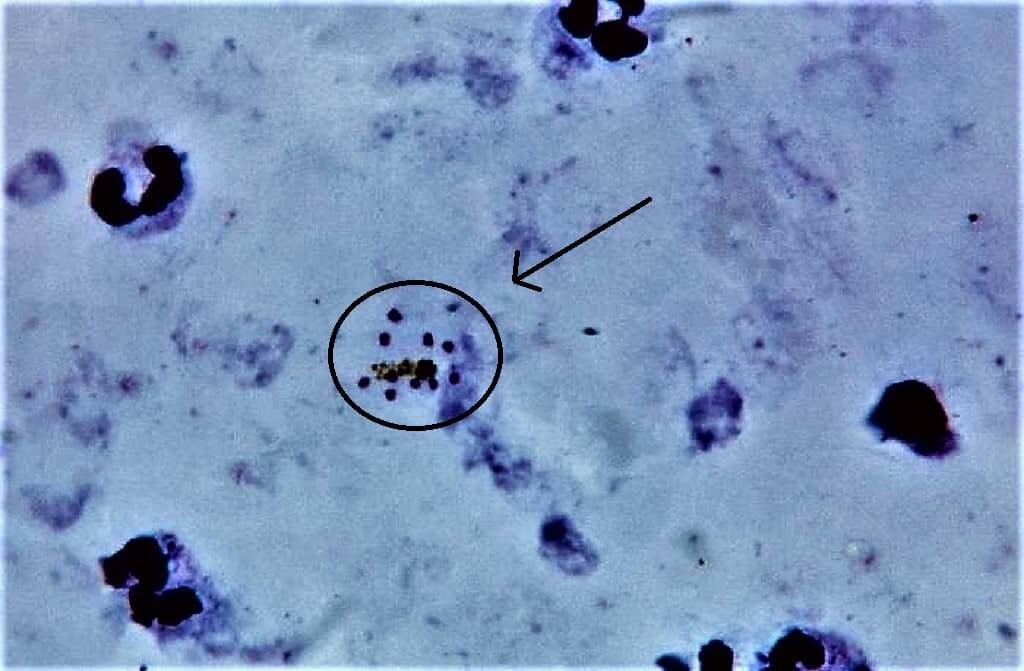 giemsa-staining-technique-principle-preparation-procedure-results