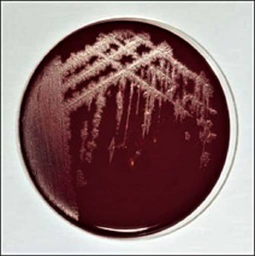 clostridium tetani on stiff blood agar medium - clostridium tetani on 3% blood agar medium