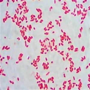 Morphology Culture Characteristics Of Escherichia Coli E Coli