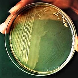 proteus vulgaris on nutrient agar medium - growth of proteus vulgaris on nutrient agar