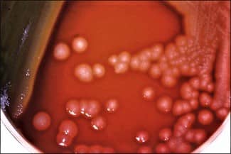 pseudomonas aeruginosa on blood agar - p aeruginosa on blood agar medium