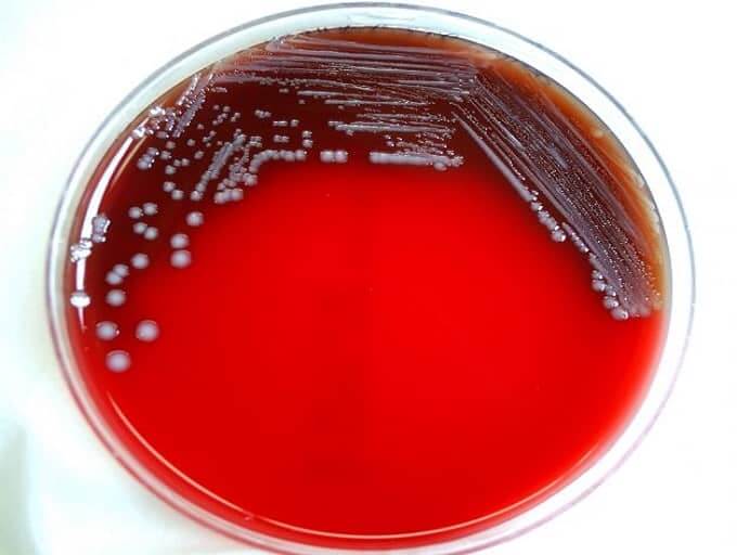 yersinia pestis on blood agar medium - y. pestis on blood agar medium