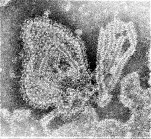 Mumps Virus - Morphology, Pathogenesis, Clinical features, Lab Diagnosis.