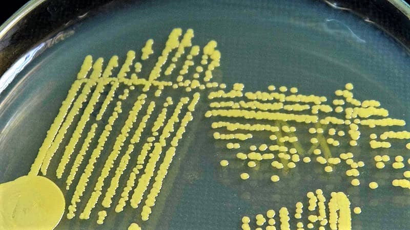 morphology-cultural-characteristics-of-staphylococcus-aureus