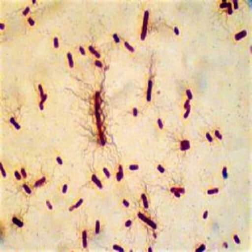 Morphology Culture Characteristics Of Proteus Vulgaris