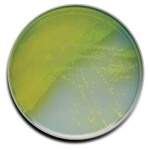 Morphology & Culture Characteristics of Pseudomonas aeruginosa