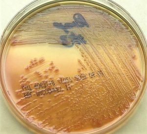 Morphology Culture Characteristics Of Pseudomonas Aeruginosa