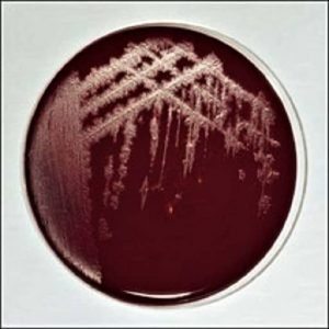 Morphology & Culture Characteristics of Clostridium tetani