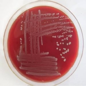 Morphology & Culture Characteristics of Klebsiella pneumoniae