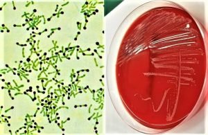 morphology of corynebacterium diphtheriae - cultural charcateristics of corynebacterium diphtheriae - culture characteristics of corynebacterium diphtheriae