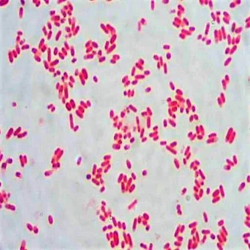morphology of escherichia coli - morphology of e.coli