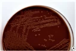 neissria gonorrhoeae on chocolate agar medium