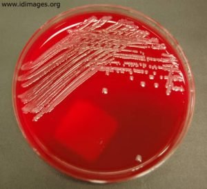 Morphology & Culture Characteristics of Salmonella typhi (S. typhi)