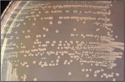 salmonella typhi on Macconkey agar medium - salmonella on macconkey agar medium