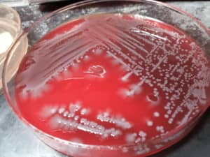 shigella dysenteriae on blood agar medium - Sh. dysenteriae on blood agar