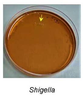 shigella dysenteriae on salmonella shigella agar medium