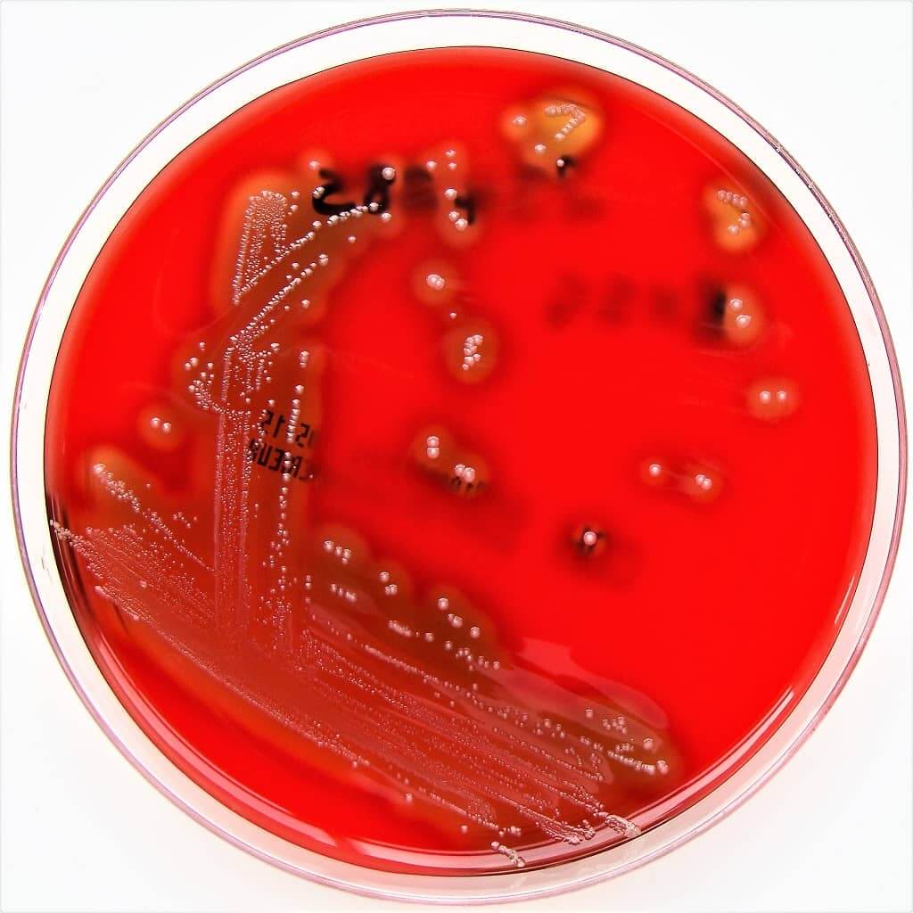 streptococcus pyogenes on columbia horse blood agar medium - streptococcus on blood agar medium