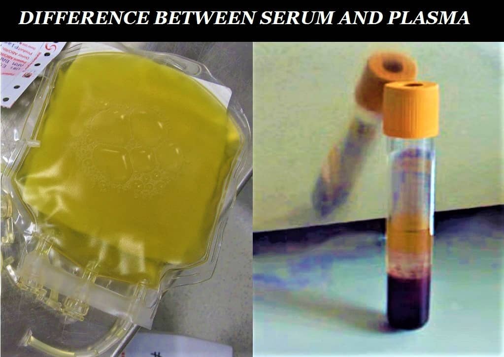 serum vs plasma