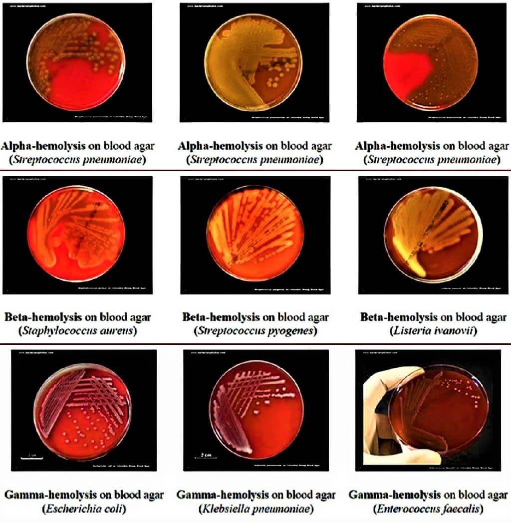 blood agar medium - various types of hemolysis - hemolysis on blood agar medium