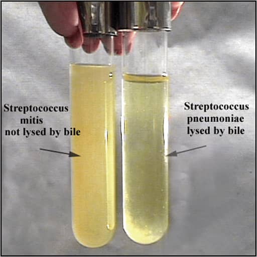 bile solubility test - streptococcus pneumoniae - bile solubility test for streptococcus pneumoniae