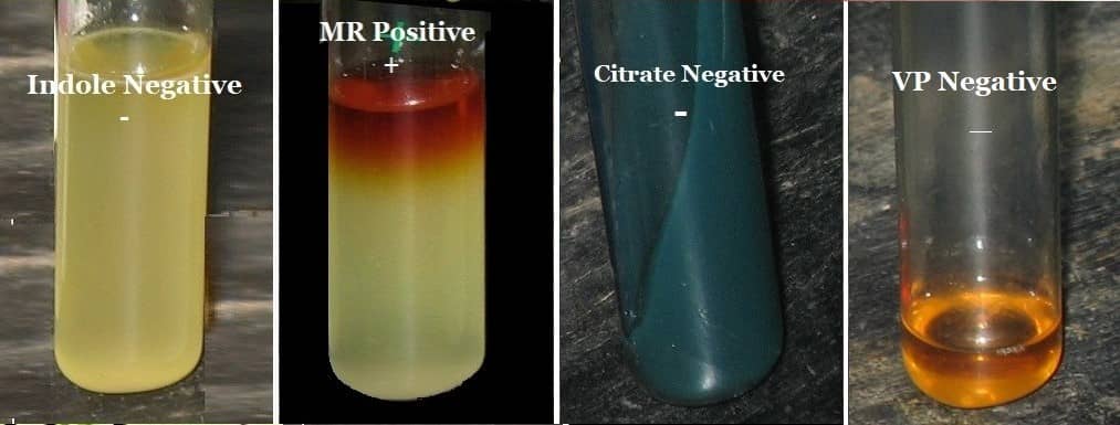 biochemical tests for corynebacterium diphtheriae - mr positive - vp negative - citrate negative - indole negative