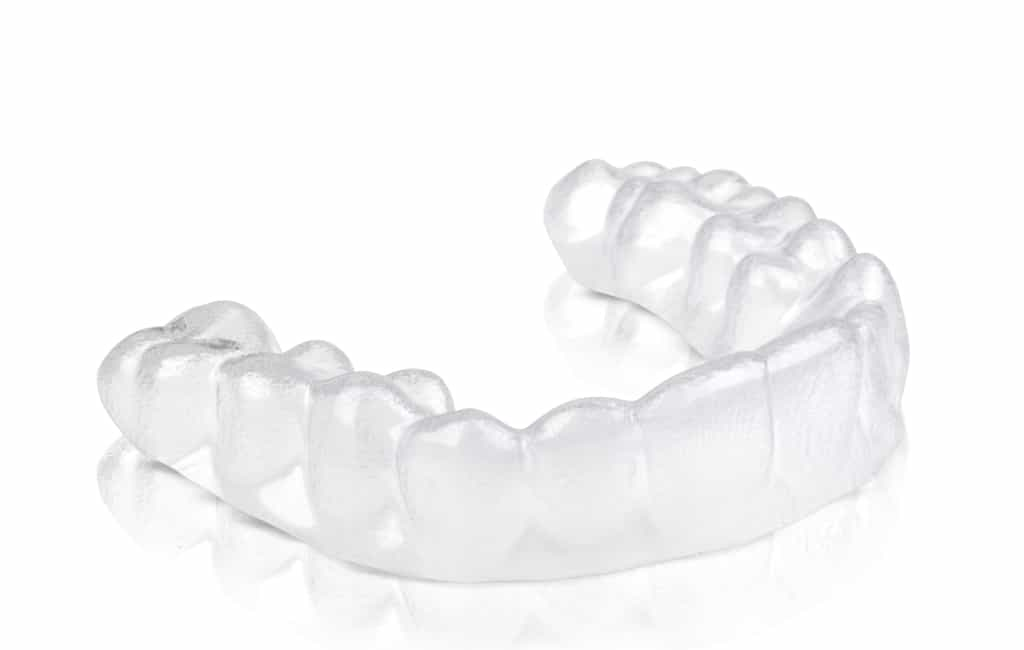 clear aligner - clear braces - Is it possible to straighten your teeth without braces - yes oral treatment without braces