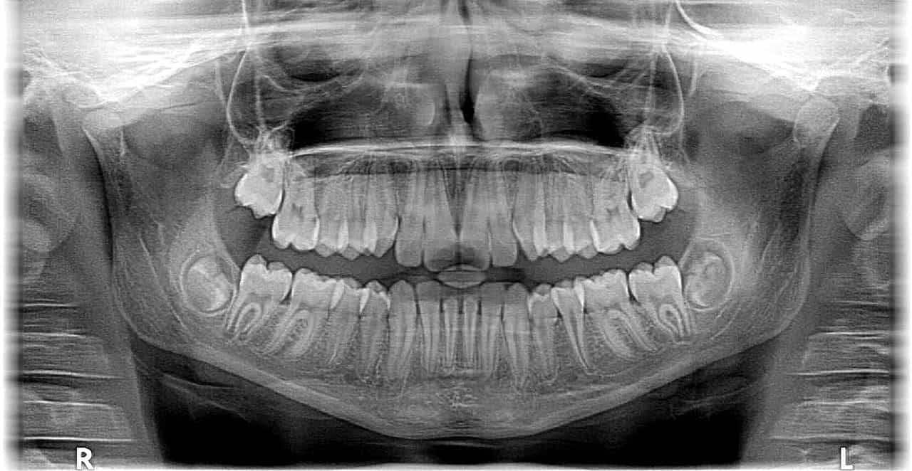 Why the Preva X-ray Is One of the Best Intraoral Imaging Machines