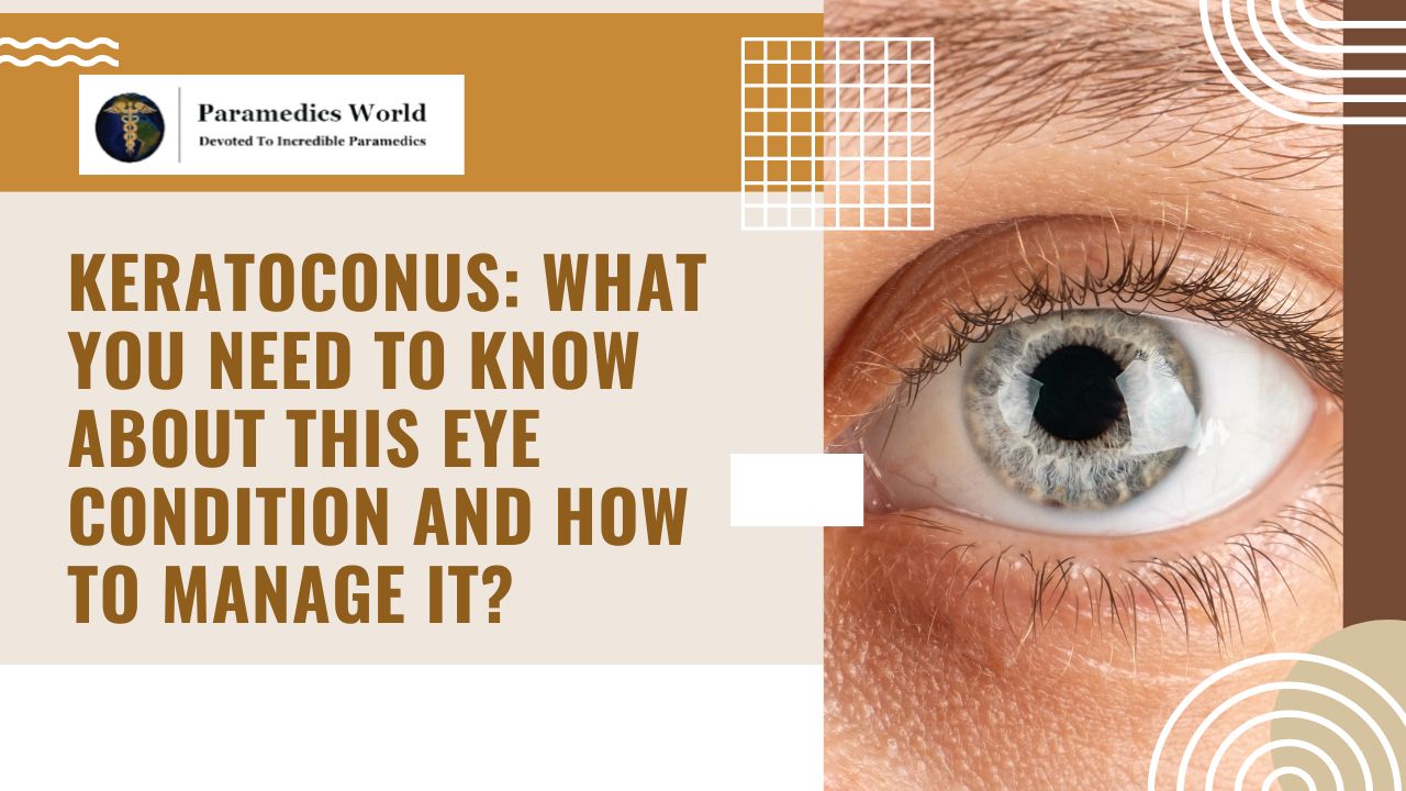 Keratoconus: What You Need to Know About this Eye Condition and How to ...