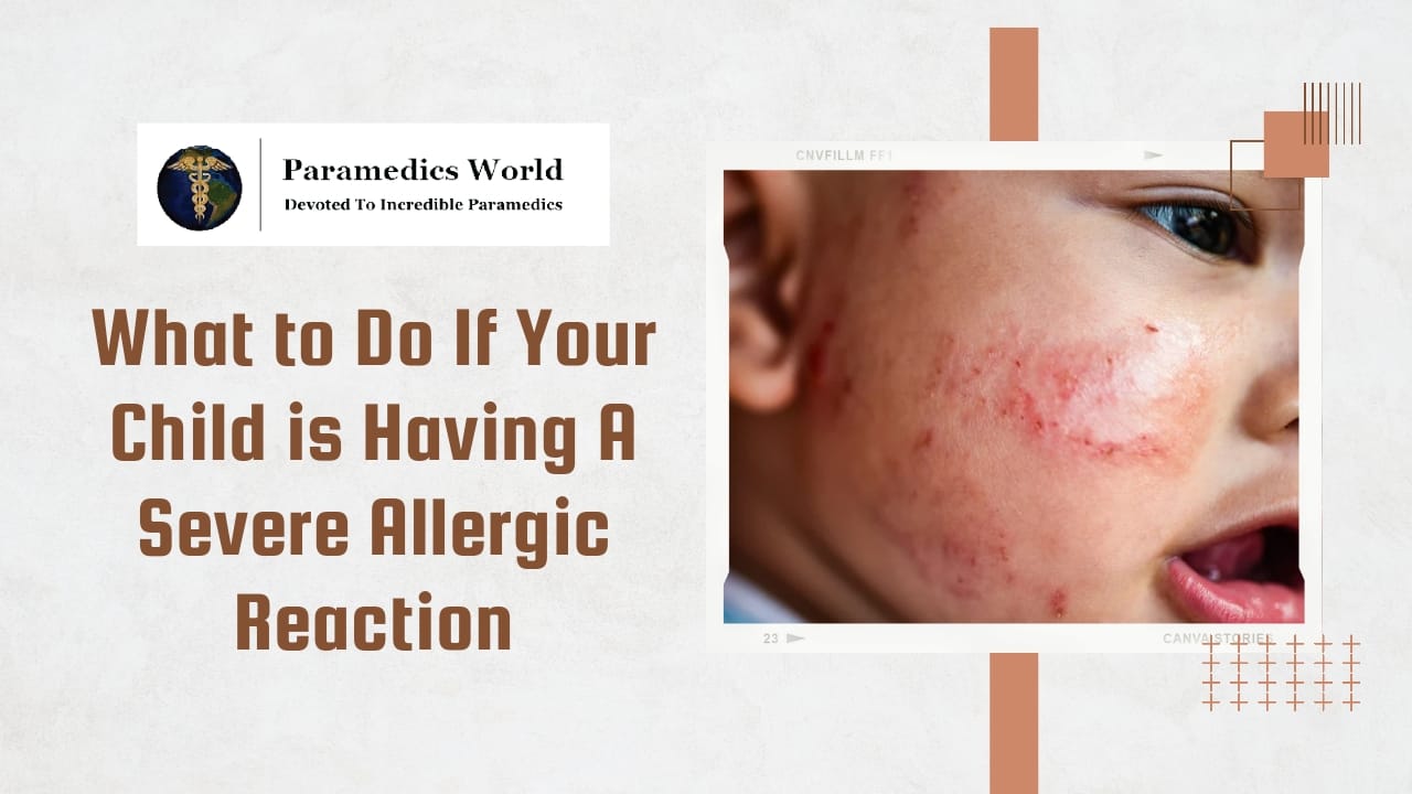 what-to-do-if-your-child-is-having-a-severe-allergic-reaction