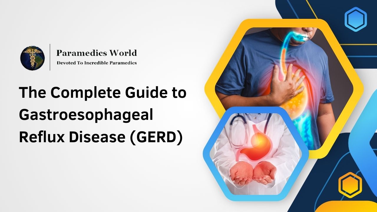 The Complete Guide to Gastroesophageal Reflux Disease (GERD)