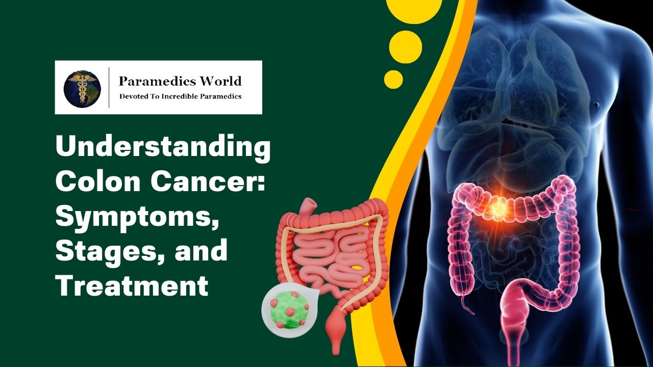 understanding-colon-cancer-symptoms-stages-and-treatment